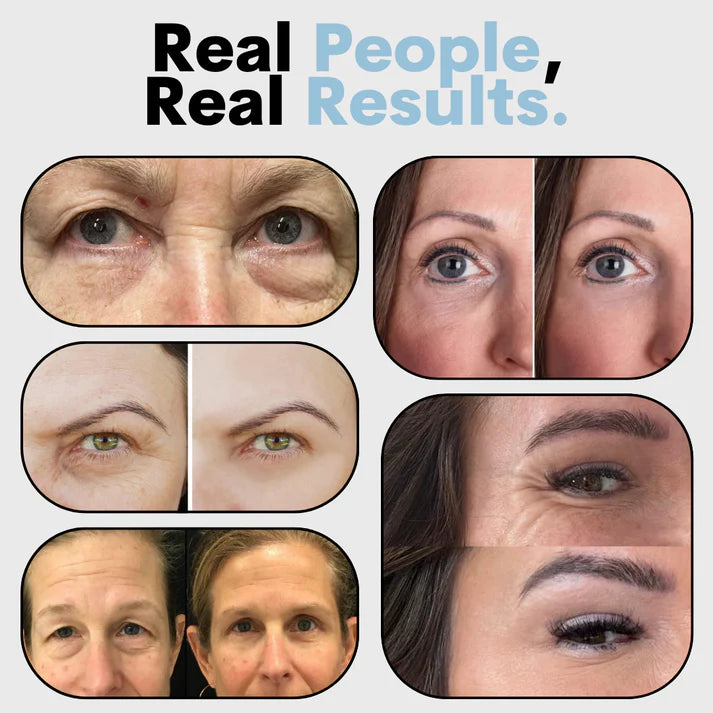 Orovita® Instant Skin Tightener