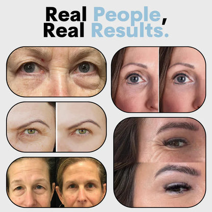 Orovita® Instant Skin Tightener