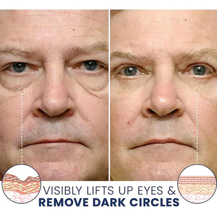 Orovita® Instant Skin Tightener