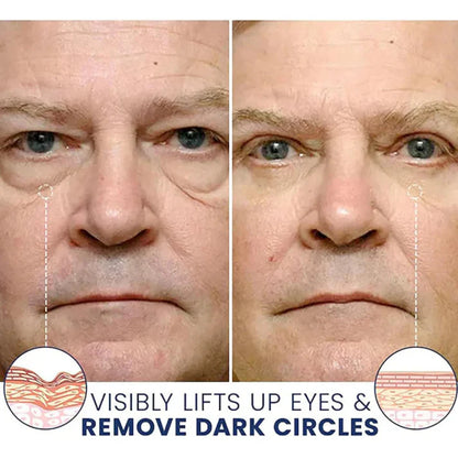 Orovita® Instant Skin Tightener