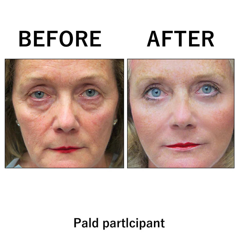 Orovita® Instant Skin Tightener