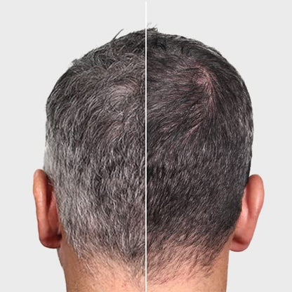 Orovita® Gray Hair Reverse Bar