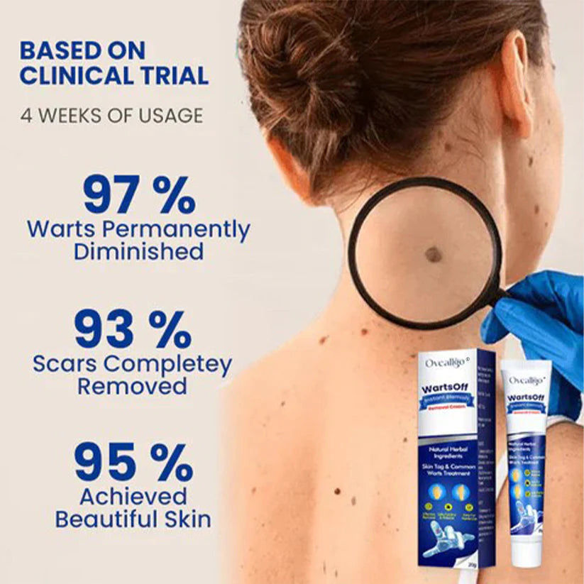 WartsOff Instant Blemish Removal Cream