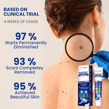 WartsOff Instant Blemish Removal Cream