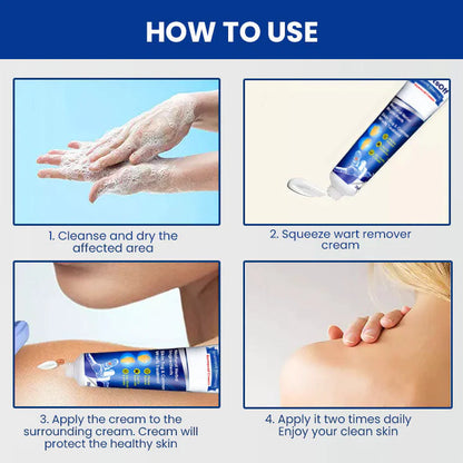 WartsOff Instant Blemish Removal Cream